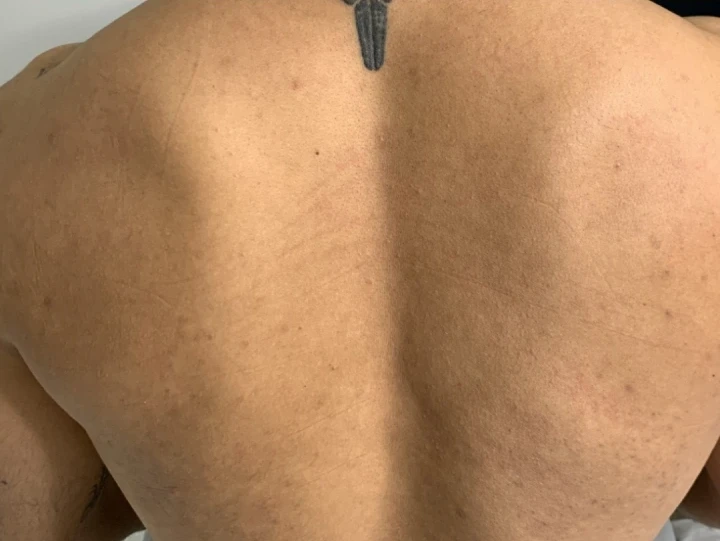 A close-up view of a person's upper back reveals pristine skin and part of a tattoo on the upper neck area, enhanced by the smooth finish achieved through New Westminster Laser Hair Removal.
